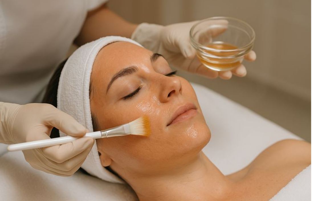 Chemical Peels