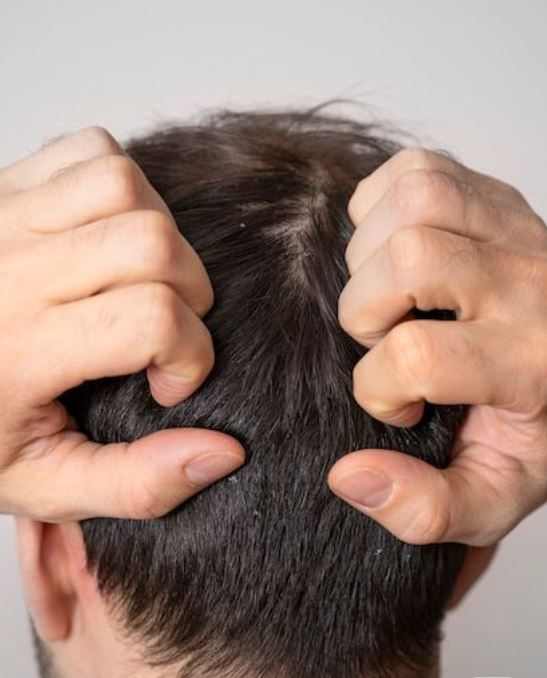 Dandruff & Scalp Care