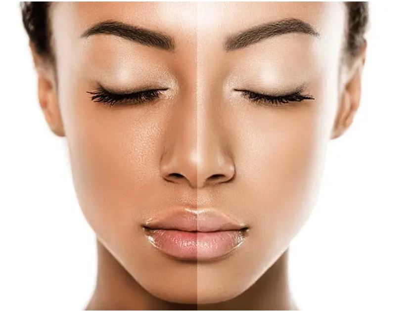 Dermatology consultation